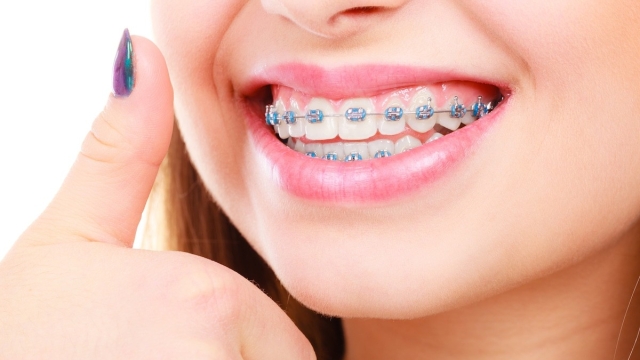 Choosing Between an Orthodontist and a Private Dentist