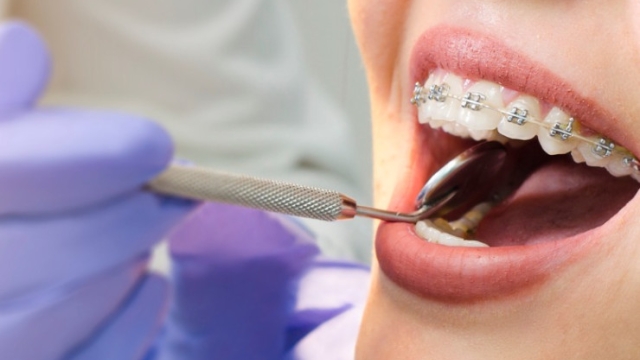 Perfecting Smiles: The Role of an Orthodontist