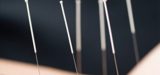 The Art of Acupuncture: Unleashing the Body’s Healing Powers